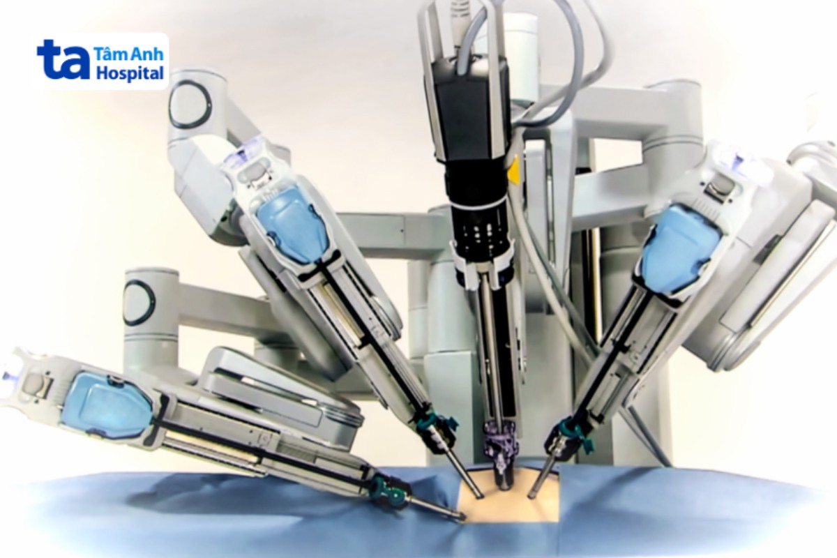 các cánh tay robot mổ