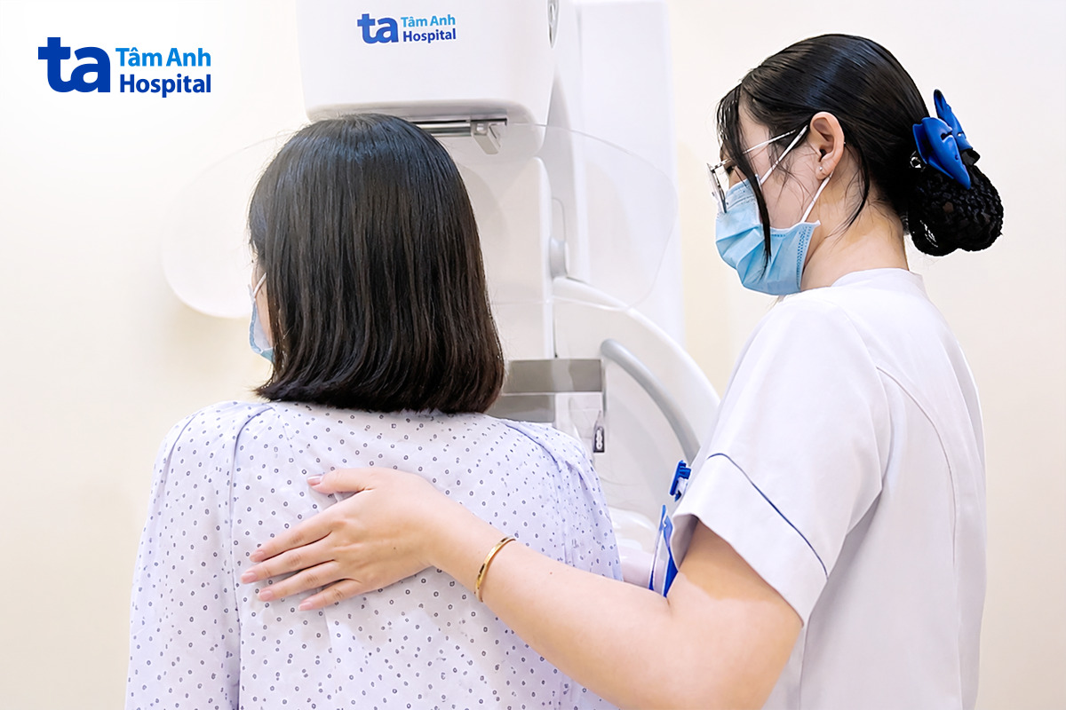 chụp xquang vú cắt lớp