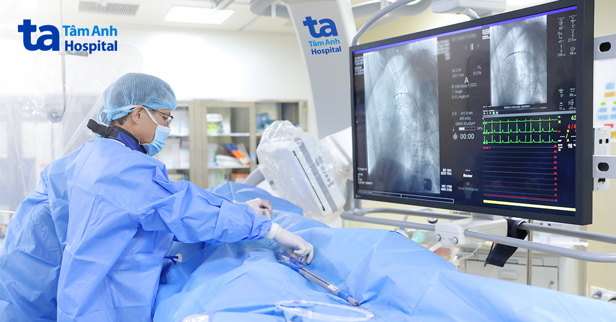 Đặt stent graft cứu người đàn ông loét động mạch chủ