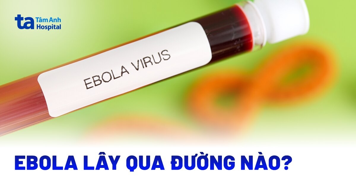 ebola lây qua đường nào