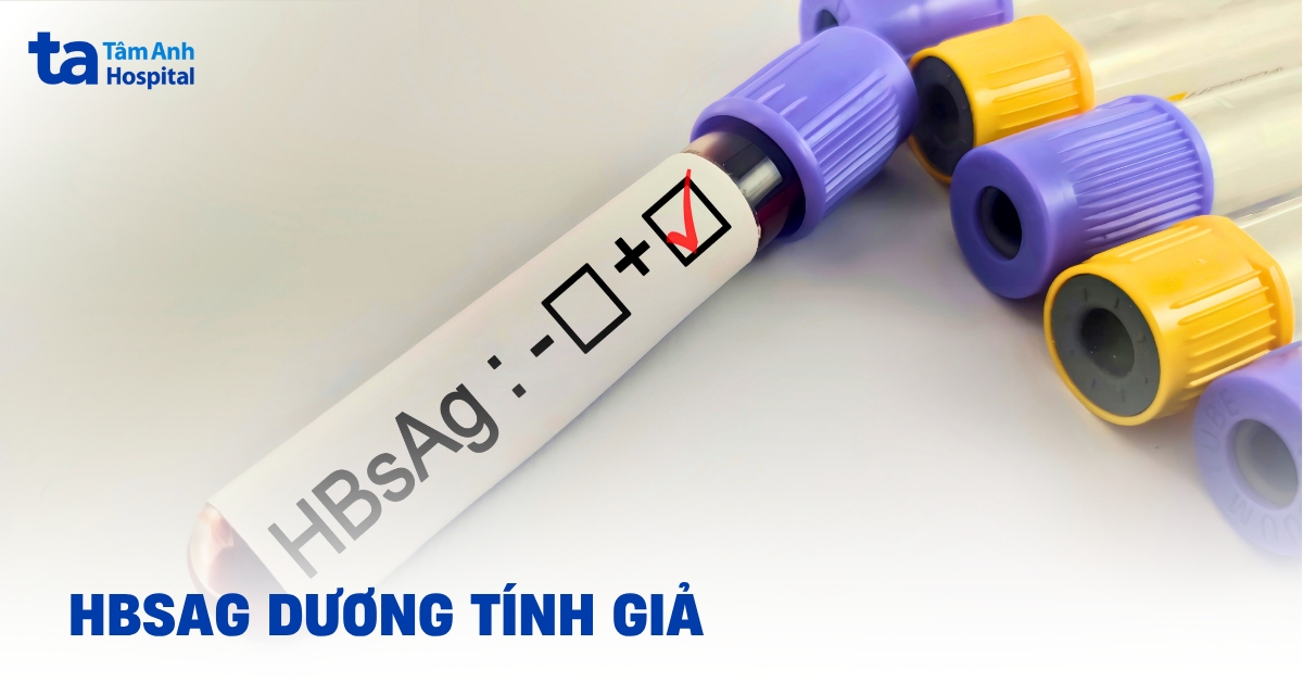 Hiểu đúng về HBsAg dương tính giả trong xét nghiệm