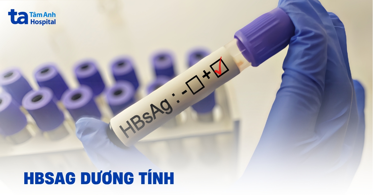 Xét nghiệm HBsAg dương tính: Bạn cần biết những gì?