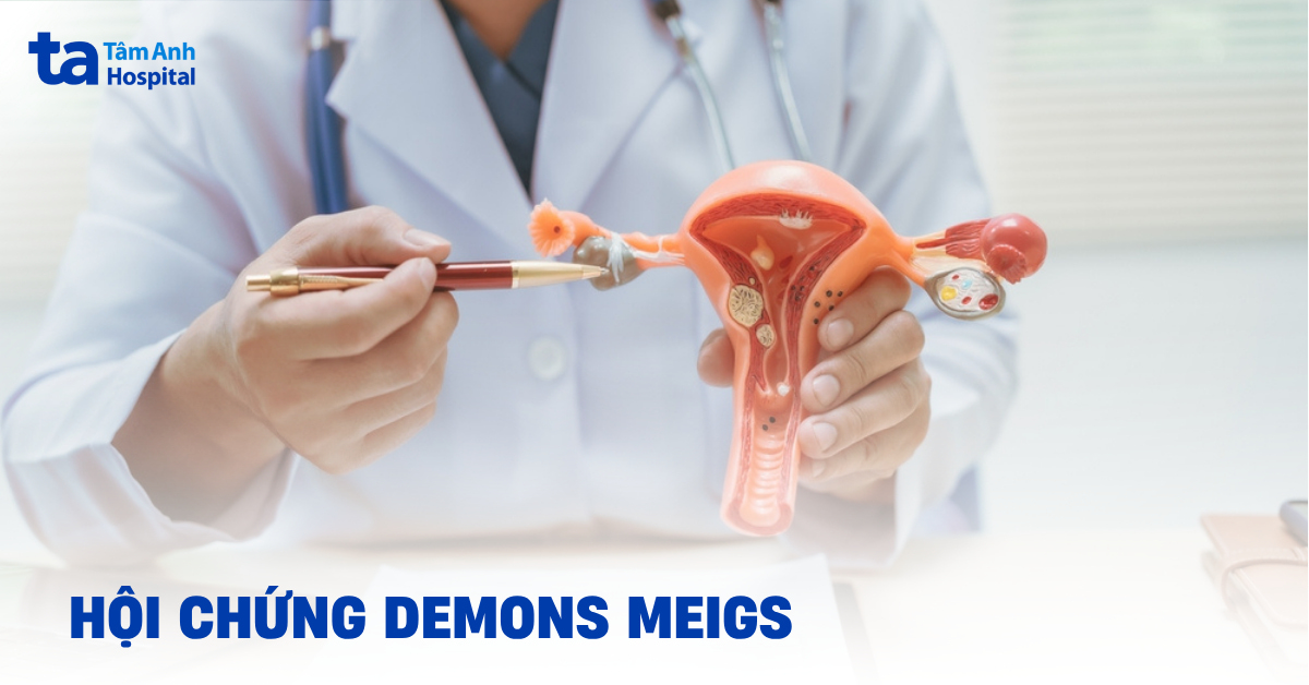 Hội chứng Demons-Meigs là gì? Khắc phục thế nào?