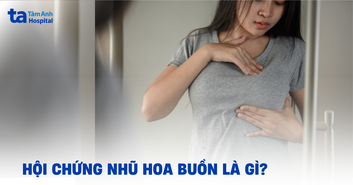 Hội chứng nhũ hoa buồn là như thế nào?