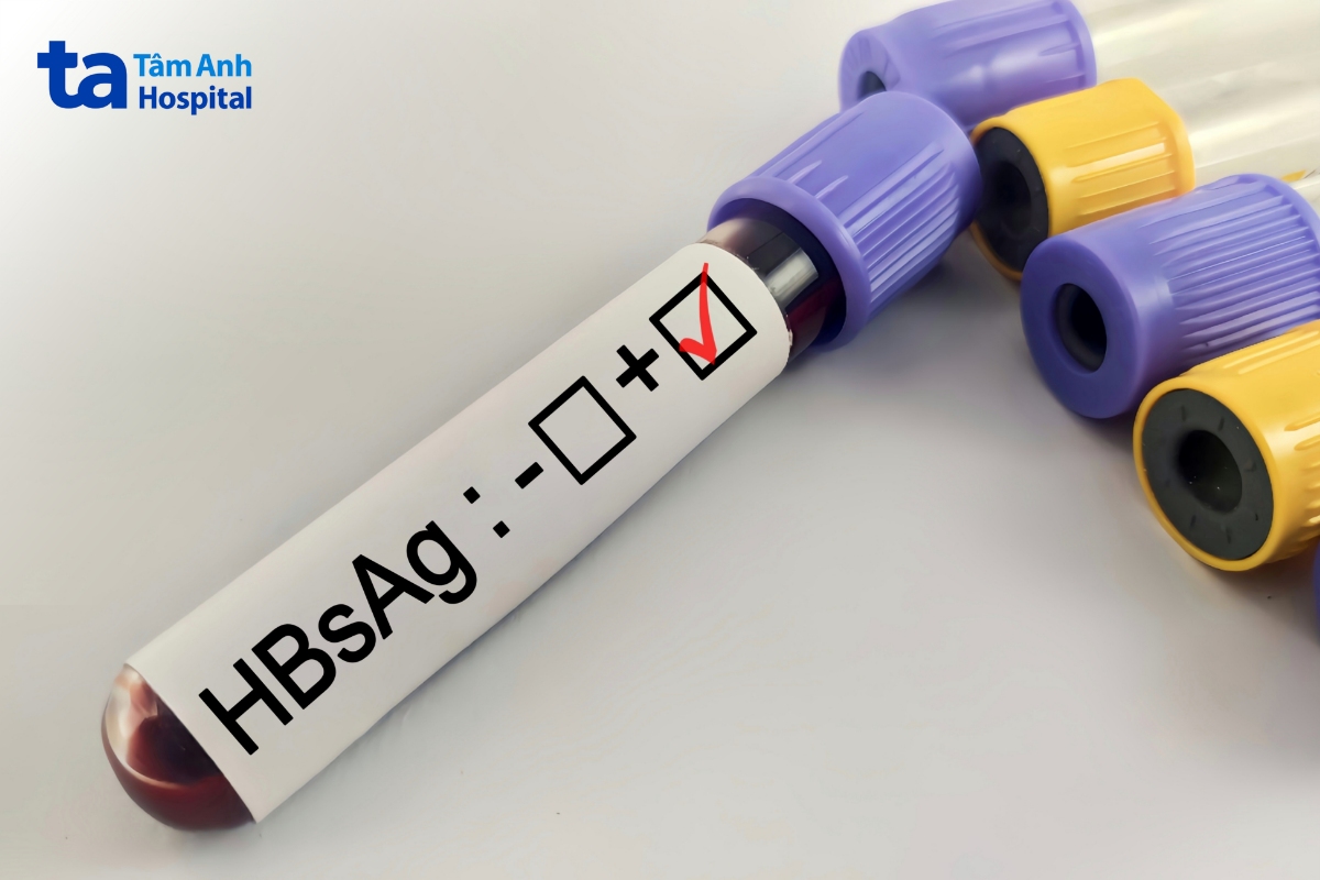 Kết Quả Xét Nghiệm Hbsag