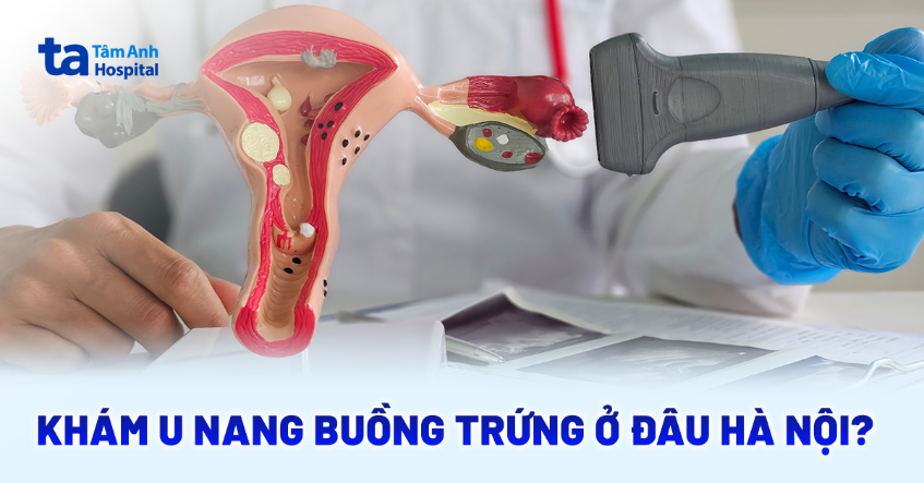 Địa chỉ khám u nang buồng trứng ở Hà Nội chất lượng cao