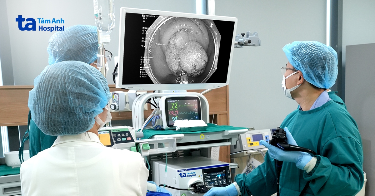 Nội soi phát hiện polyp ruột thừa hiếm gặp, nguy cơ ung thư