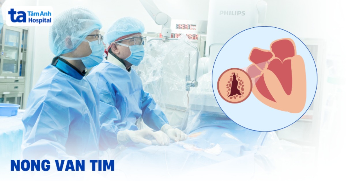 Tái phát đột quỵ do thông động tĩnh mạch phổi bẩm sinh
