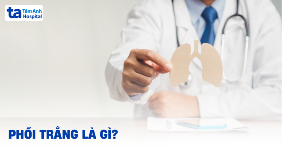 Phổi trắng là gì? Nguyên nhân, điều trị và phòng ngừa bệnh