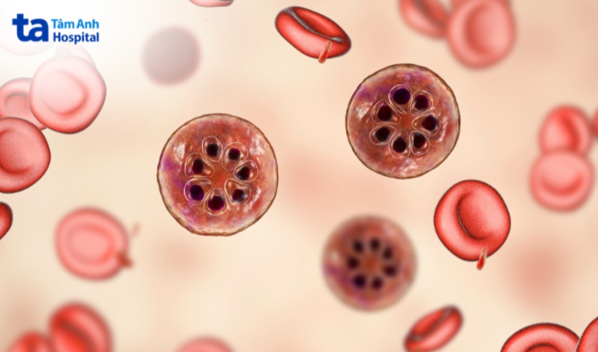 plasmodium gây sốt ở người lớn