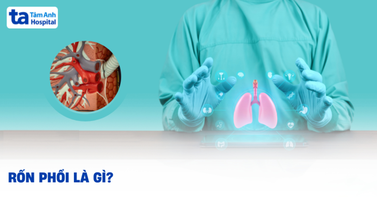Rốn phổi là gì và những bệnh lý liên quan có thể gặp?