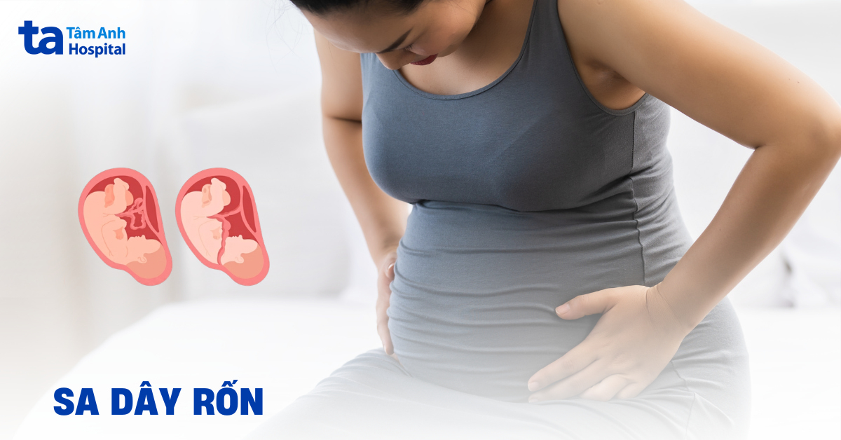 Sa dây rốn là gì? Dấu hiệu nhận biết sớm mẹ bầu cần lưu ý