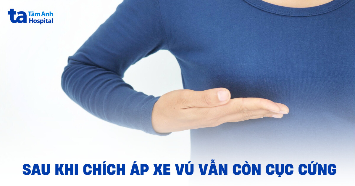 Sau chích áp xe vú vẫn còn cục cứng có đáng lo ngại?