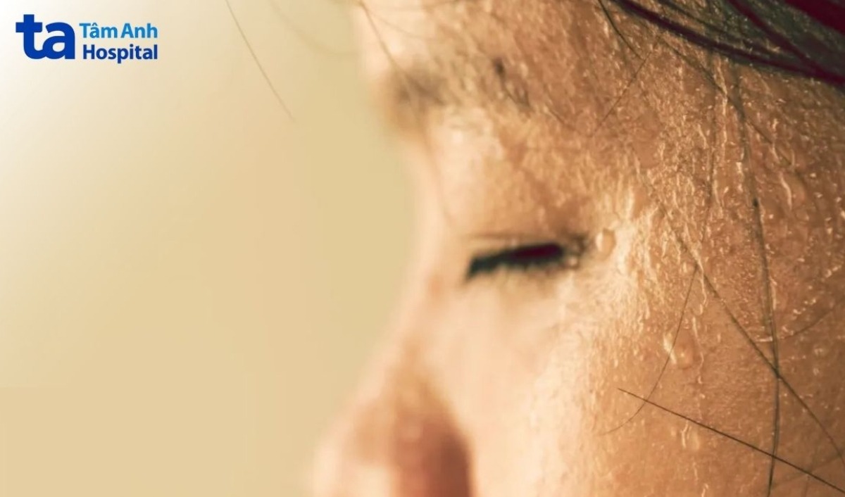 dấu hiệu sốt kèm đổ mồ hôi hột
