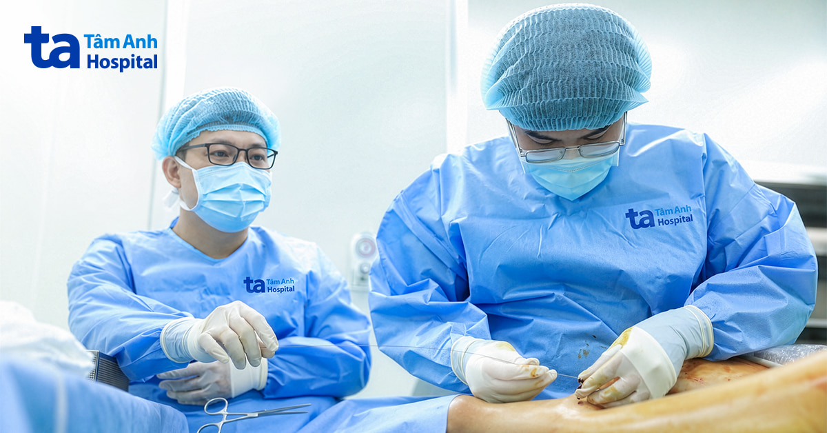 Suy giãn tĩnh mạch sau 50 năm đứng lễ nhà thờ