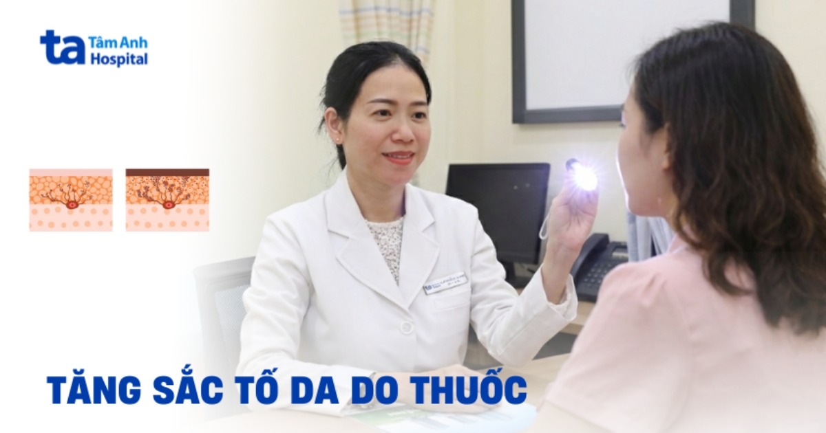 Vấn đề tăng sắc tố da do thuốc uống có thể xảy ra không?