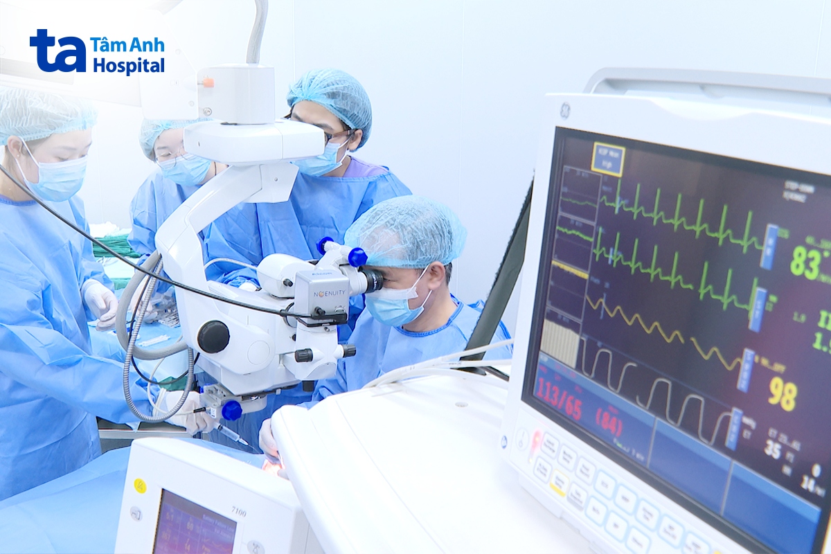 thực hiện ghép giác mạc cho bệnh nhân giác mạc chóp độ 4