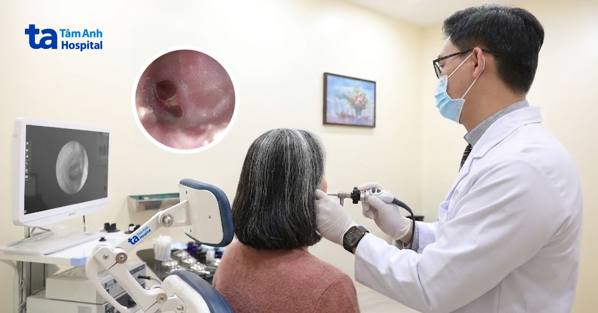 Thủng màng nhĩ trên chuyến bay từ Úc về Việt Nam