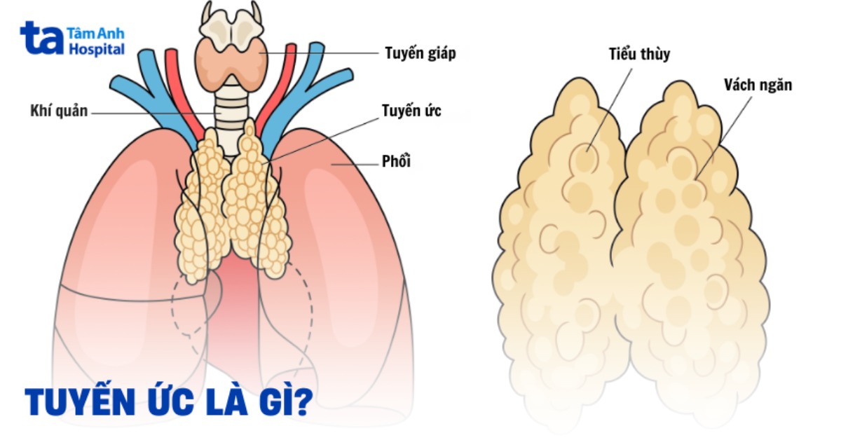 Tuyến ức: Giải phẫu vị trí, chức năng và các bệnh lý thường gặp