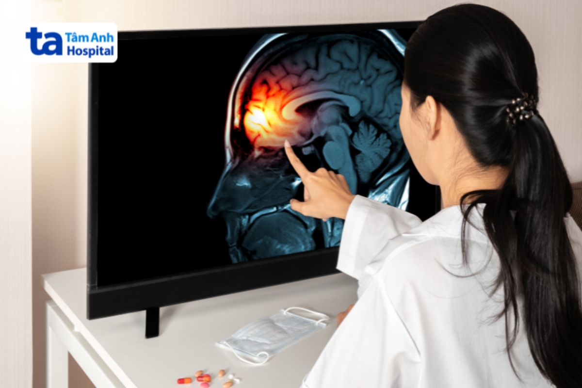 vị trí viêm màng não tăng bạch cầu ái toan