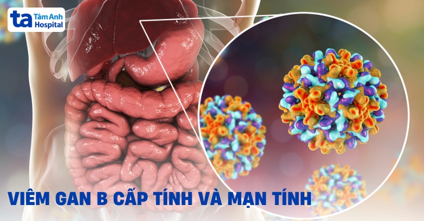 Phân biệt viêm gan B cấp tính và mạn tính