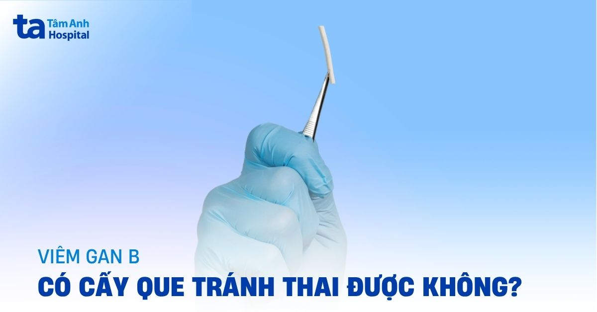 Mắc viêm gan B có cấy que tránh thai được không?