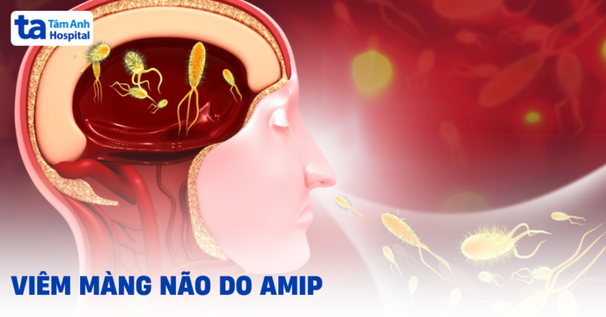 Viêm màng não do amip và những thông tin cần biết