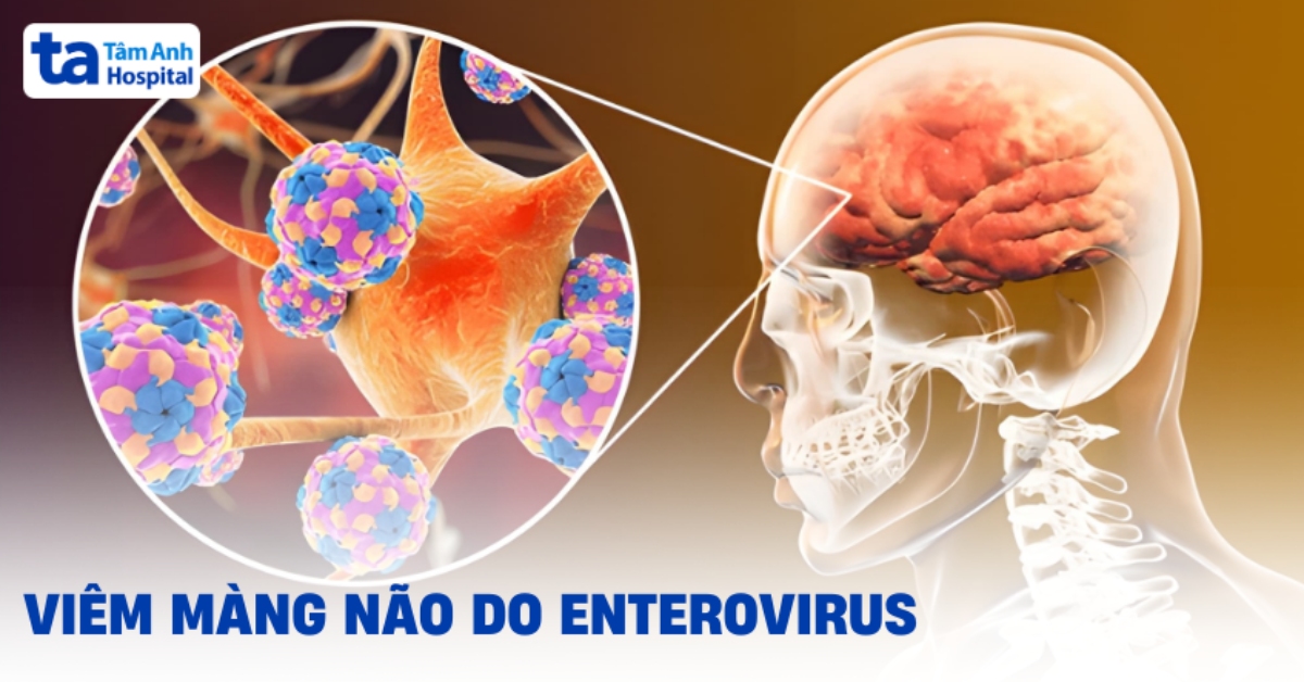 Viêm màng não do Enterovirus: Các bậc cha mẹ cần hiểu rõ