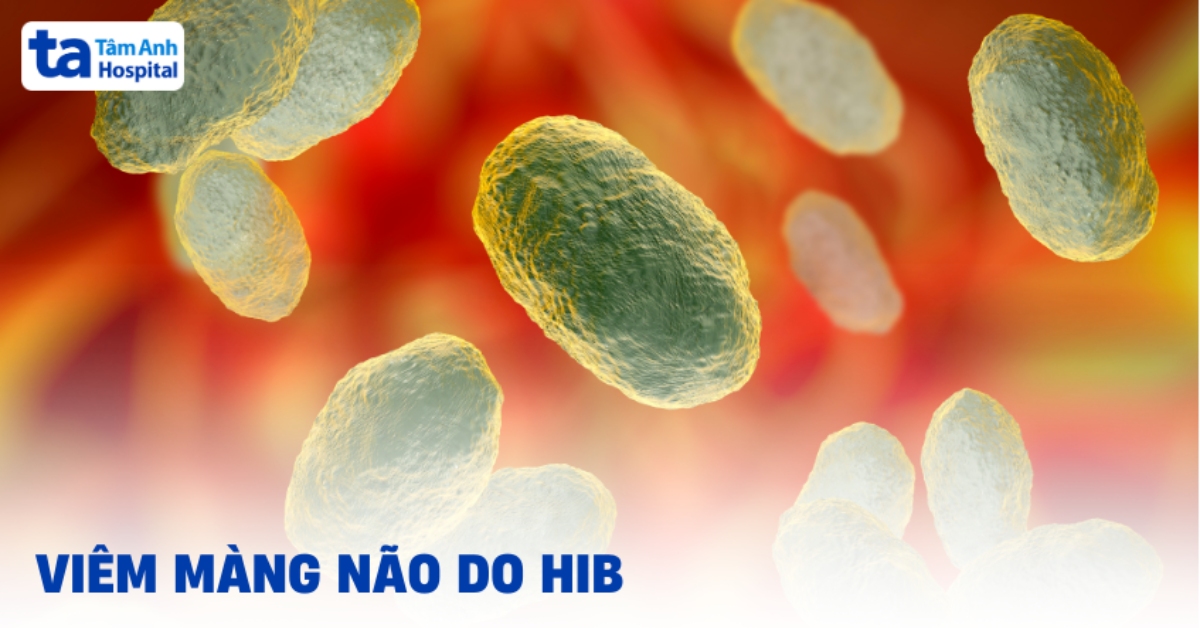 Viêm màng não do Hib: Giải pháp thế nào?