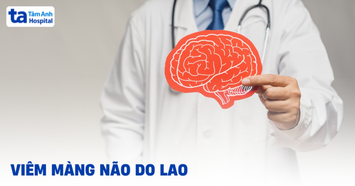 Viêm màng não do lao cần xử trí thế nào?