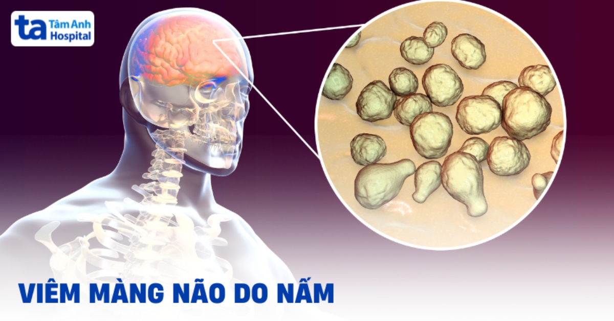 Viêm màng não do nấm: Nguyên nhân, dấu hiệu, cách điều trị