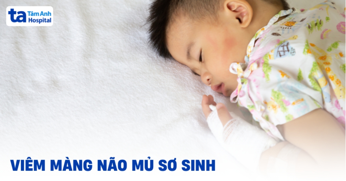 Viêm màng não mủ ở trẻ sơ sinh: Cảnh giác từ sớm