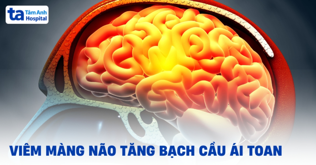 Thông tin về viêm màng não tăng bạch cầu ái toan