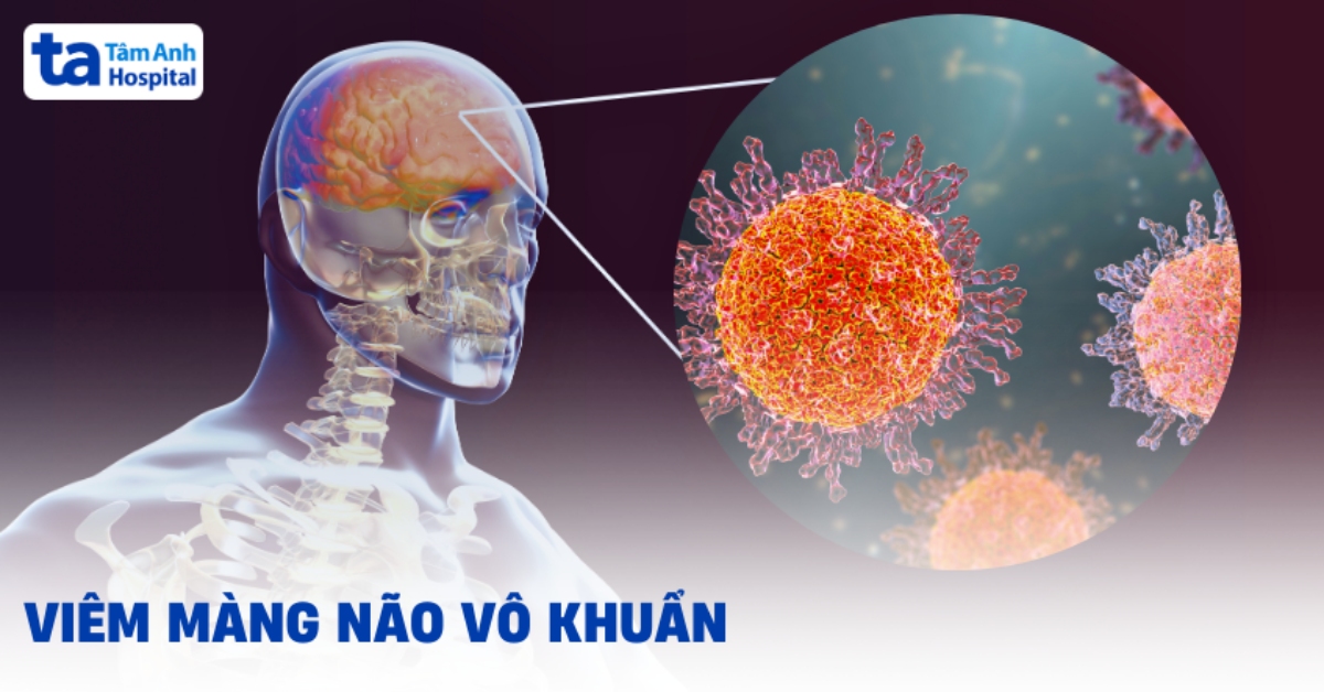 Viêm màng não vô khuẩn: Định nghĩa thế nào?