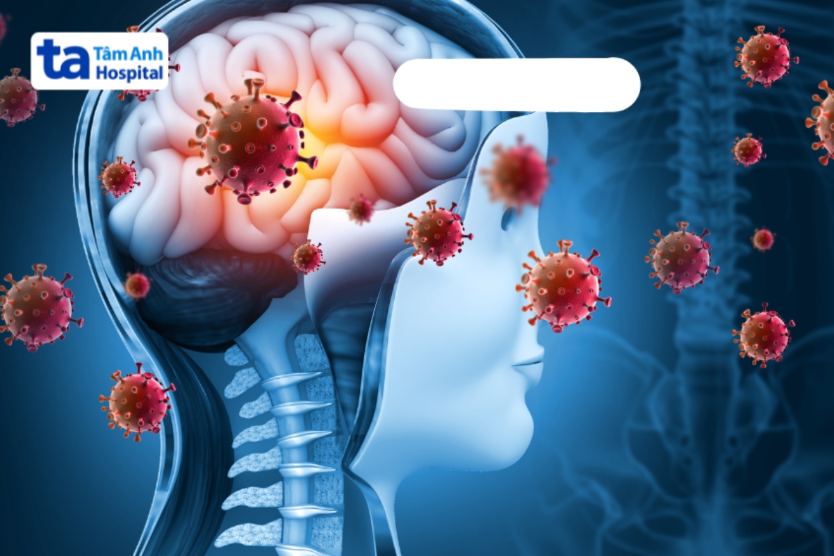 virus gây viêm màng não