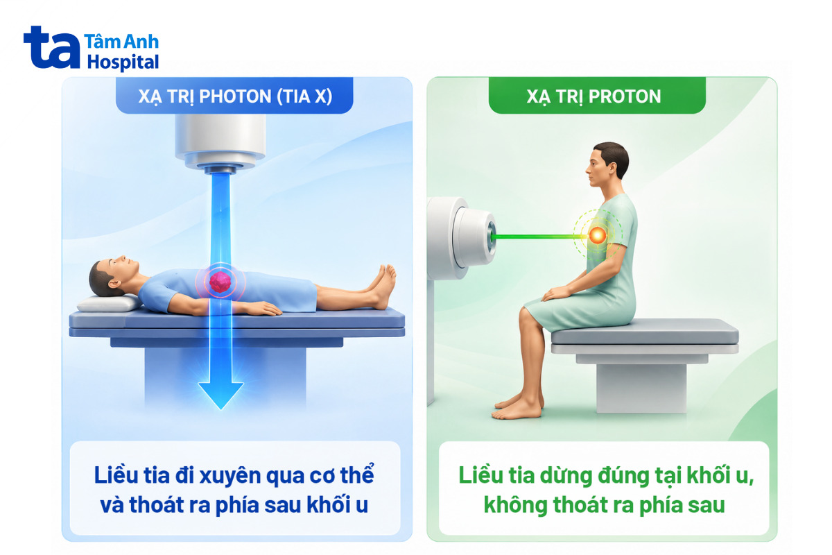 xạ trị photon có thể ảnh hưởng mô lành còn xạ trị proton dừng đúng khối u