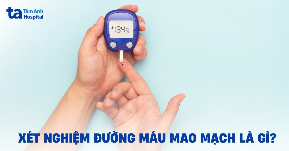 Xét nghiệm đường máu mao mạch là gì? Quy trình xét nghiệm ra sao?