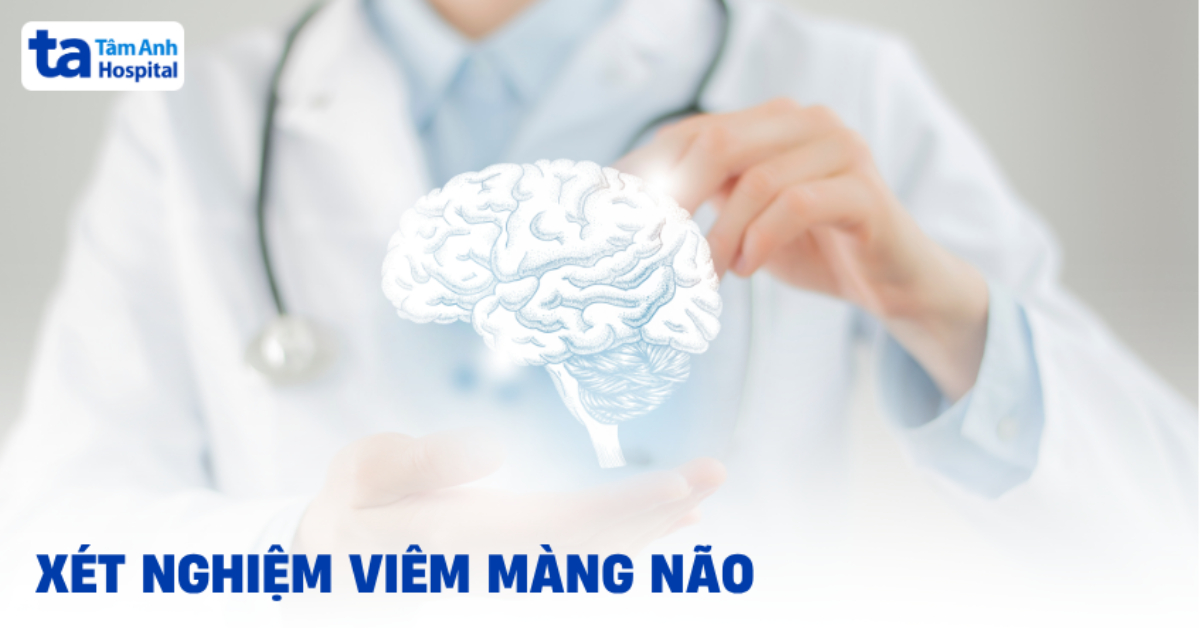Xét nghiệm viêm màng não bằng cách nào? Chi phí ra sao?