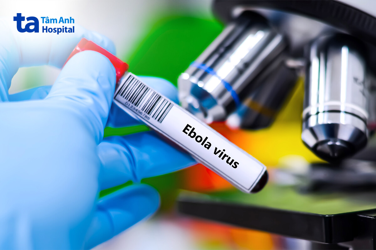 xét nghiệm virus ebola trong phòng thí nghiệm