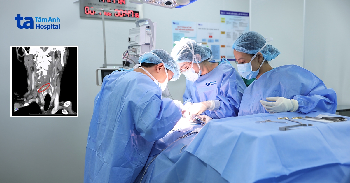 Xương cá dài 5 cm xuyên sâu vào họng người đàn ông