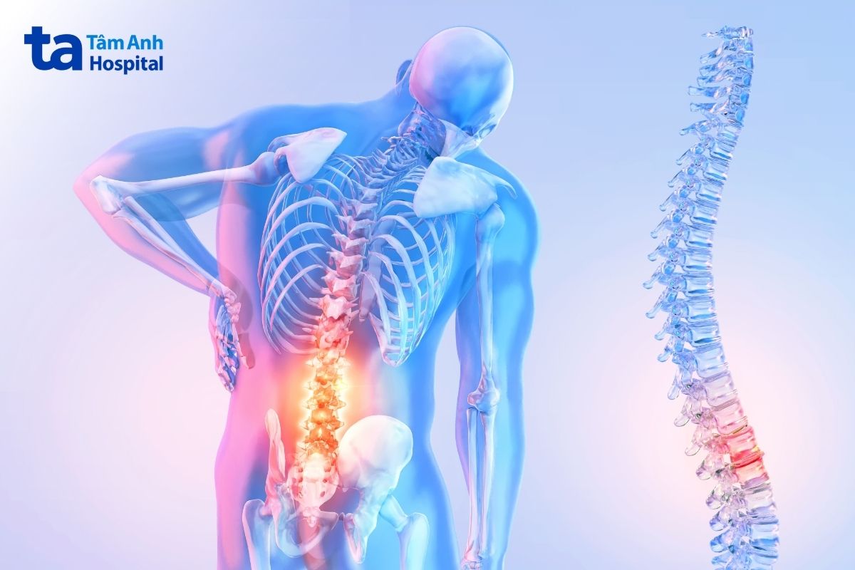 Các bệnh lý xương khớp có thể gây biến chứng nguy hiểm