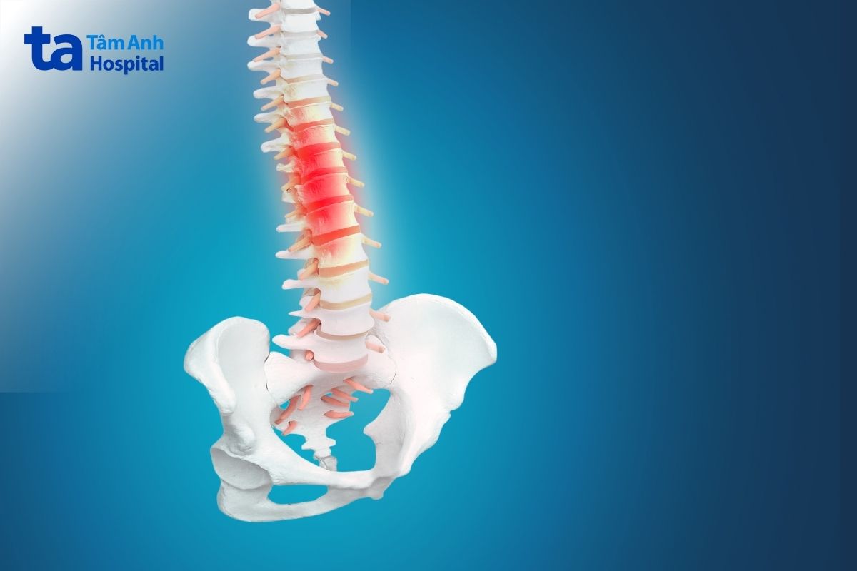 Chủ Động Phòng Ngừa Bệnh Thoái Hóa Cột Sống