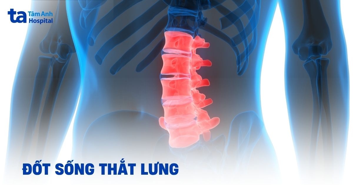Đặc điểm của các đốt sống thắt lưng: Giải thích chi tiết