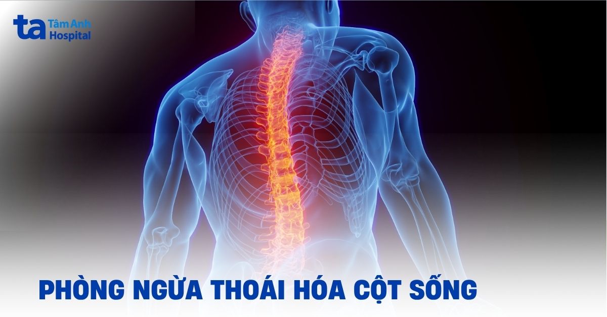 Phòng Ngừa Thoái Hóa Cột Sống