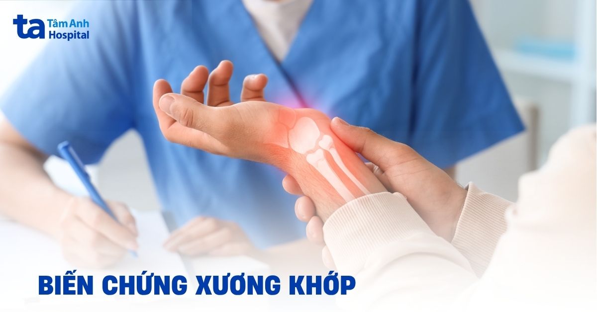 8 biến chứng xương khớp nguy hiểm có thể gặp phải cần lưu ý