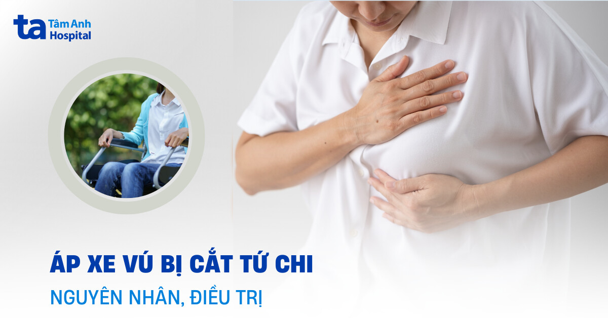Nguy cơ áp xe vú bị cắt tứ chi xảy ra khi nào?