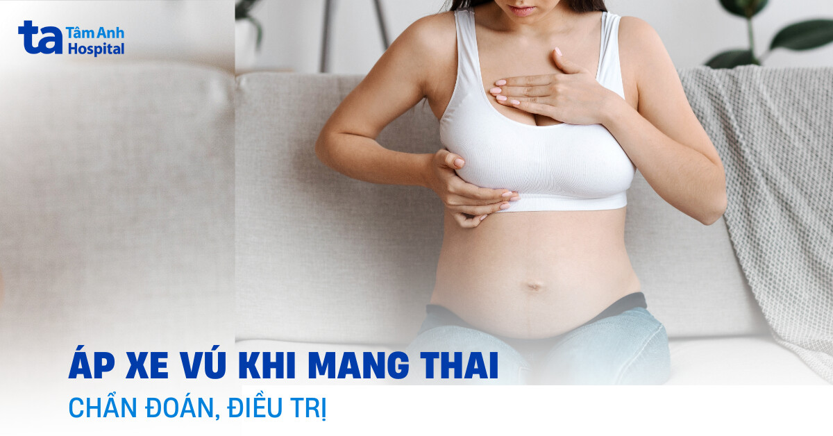 Áp xe vú khi mang thai: Nhận biết và hướng xử lý