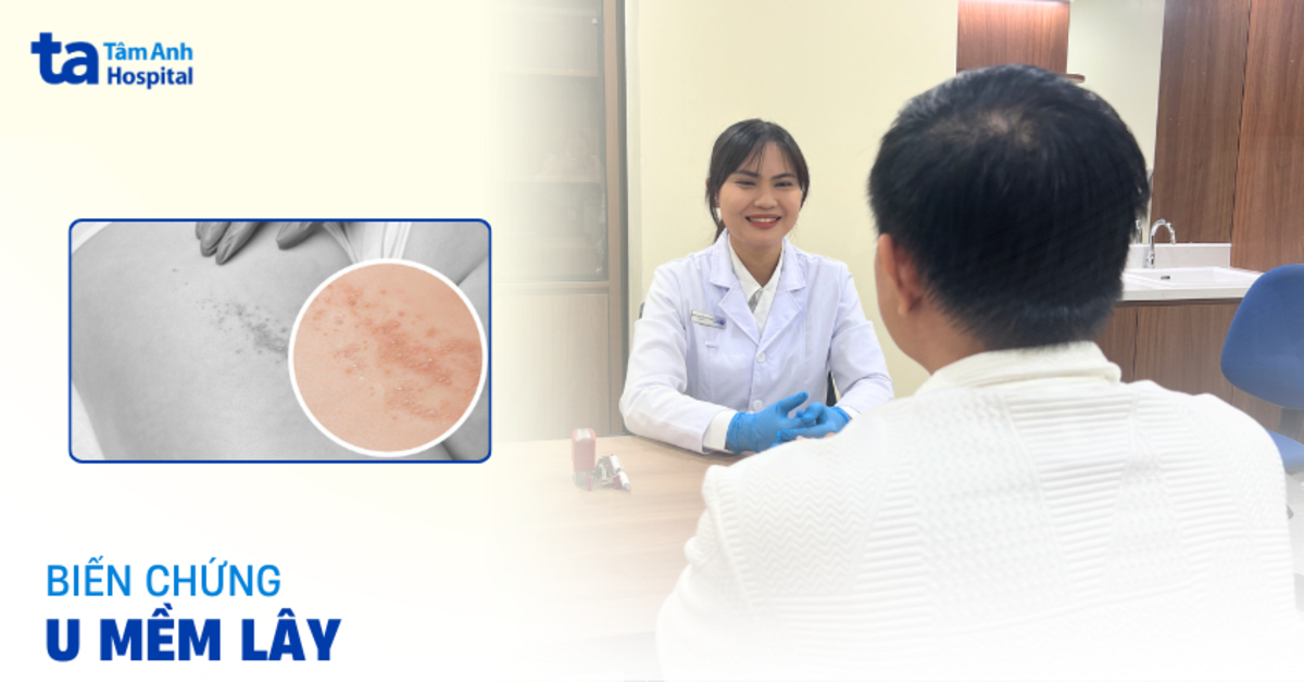 Biến chứng u mềm lây khi không điều trị kịp thời