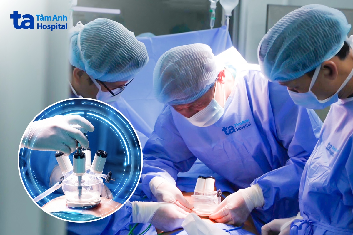 Ca phẫu thuật ứng dụng công nghệ Single-site