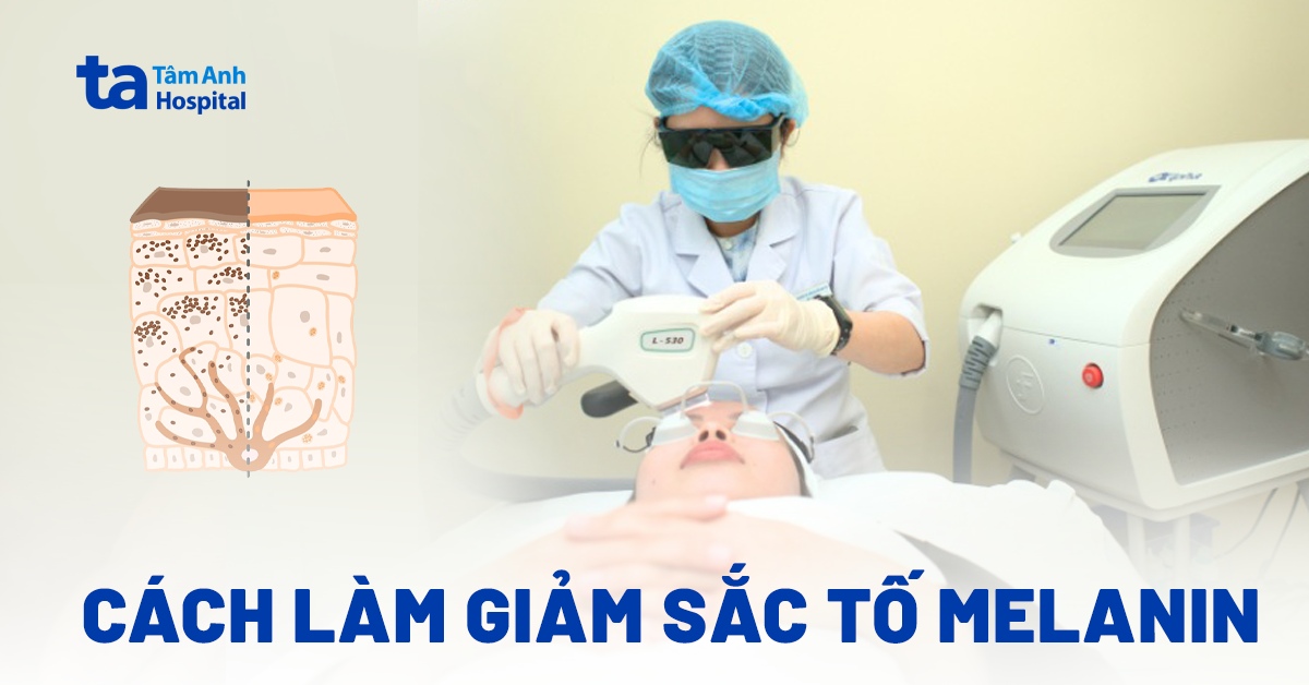Có những cách làm giảm sắc tố melanin nào nhanh và đảm bảo?